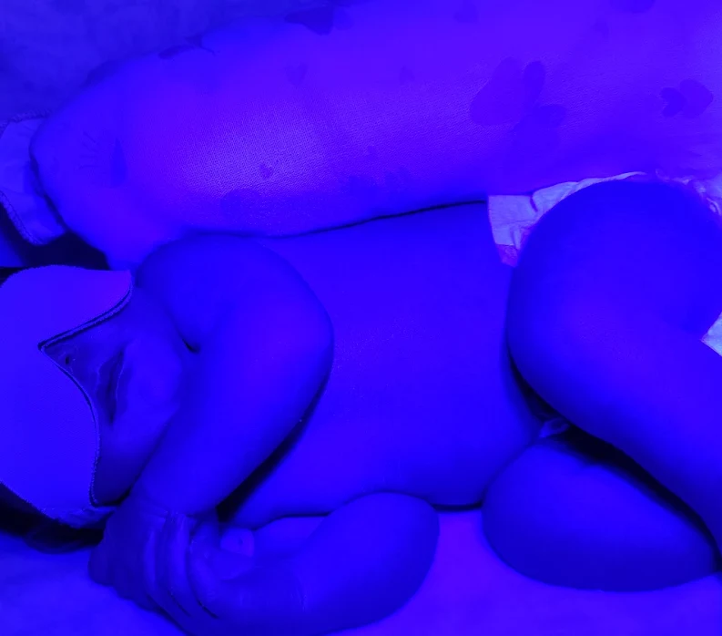 Banho de luz com LED: aparelhos aprovados para fototerapia neonatal