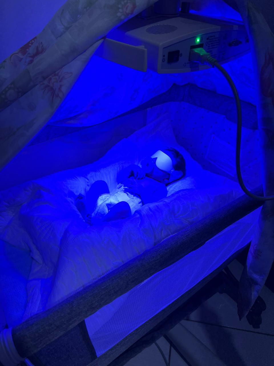 Banho de Luz para Bebê com Icterícia na Baixada Santista: Como Funciona e Como Fazer em Casa